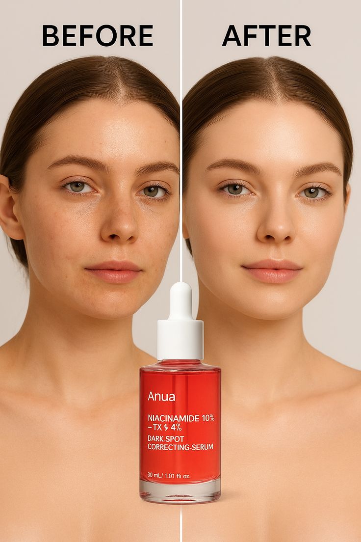 Anua Niacinamide 10% + TXA 4% Serum 30ml – Dark Spots & Acne Marks Treatment