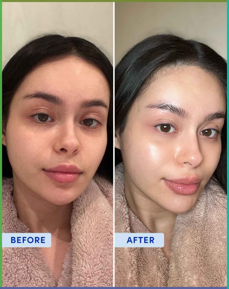 AXIS-Y Dark Spot Correcting Glow Serum 50ml – Korean Niacinamide Serum (Original)